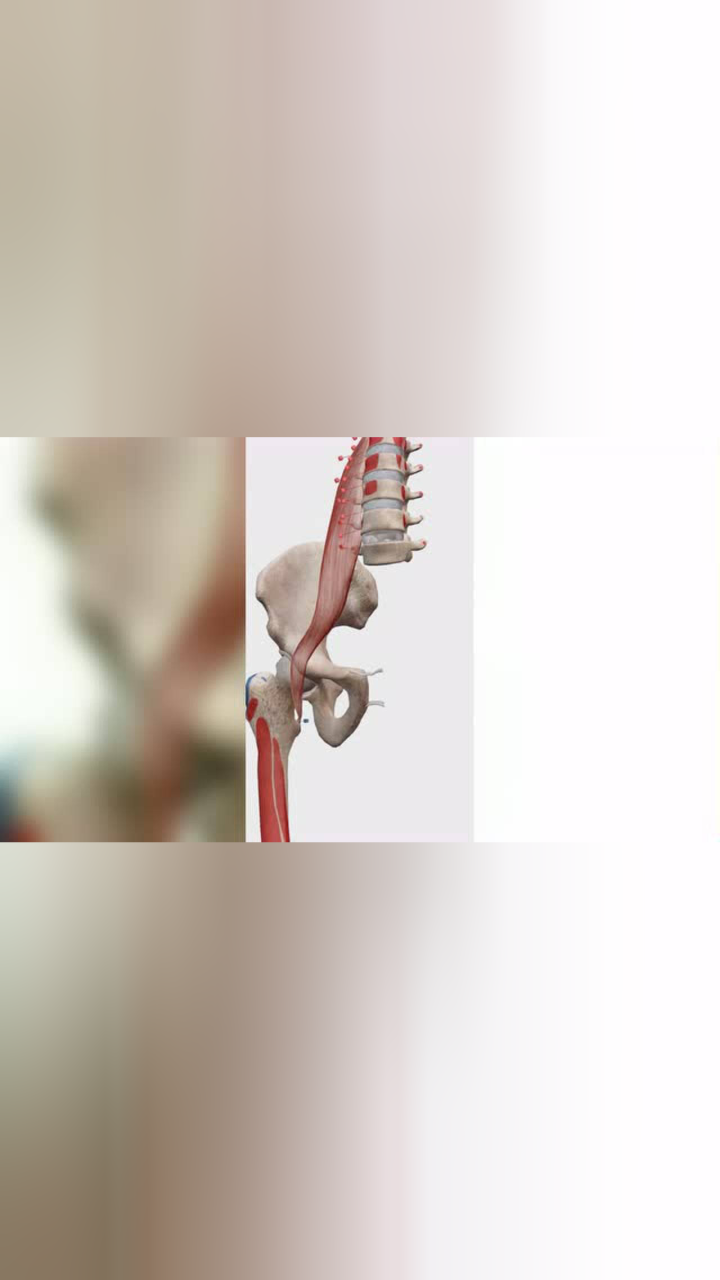 髂腰肌四宗罪之三腰大肌紧张导致髋关节内旋受限