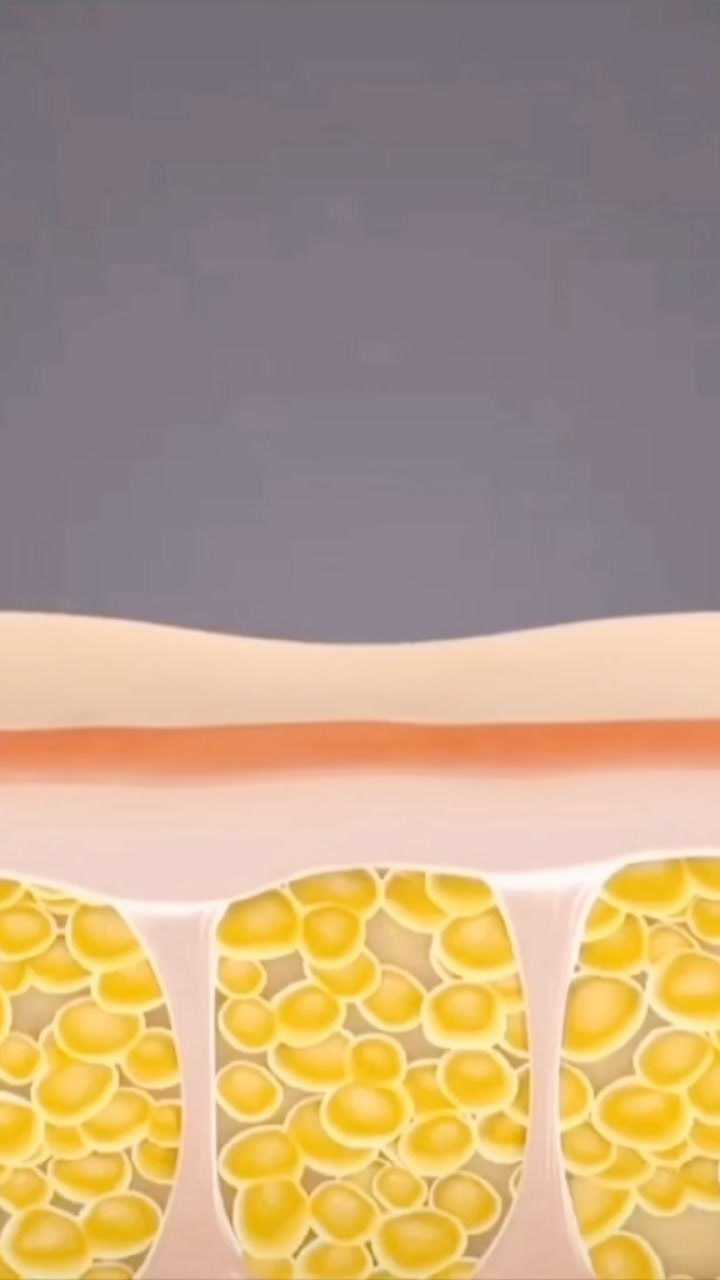 女人肚子上的脂肪很容易堆积!