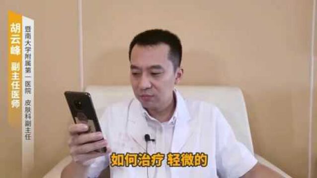 “暗藏玄机”的毛周角化,该如何治疗?医生来说清