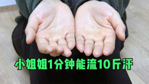 18歲小姑娘得了多汗症,手掌1分鐘能流10斤汗,腋下更是尷尬!