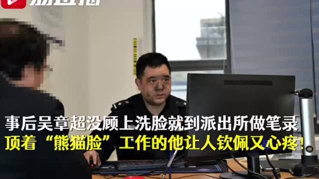 民警为何顶着“熊猫脸”做笔录?真相是…