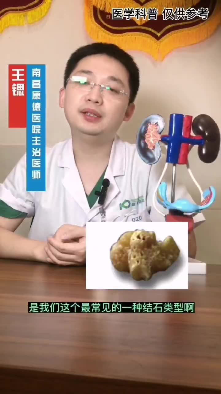 草酸钙结石防复发指南
