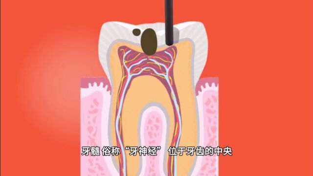 牙髓破坏后导致牙痛 出现牙齿松动,牙龈肿胀