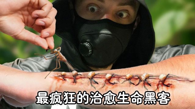 用猫制作的钢琴,鲸鱼的尸体,蚂蚁缝合术,最疯狂的治愈生命黑客