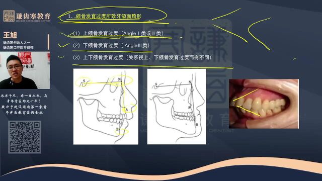 谦齿寒2023年口腔执业含助理医师资格考试——颌面部畸形