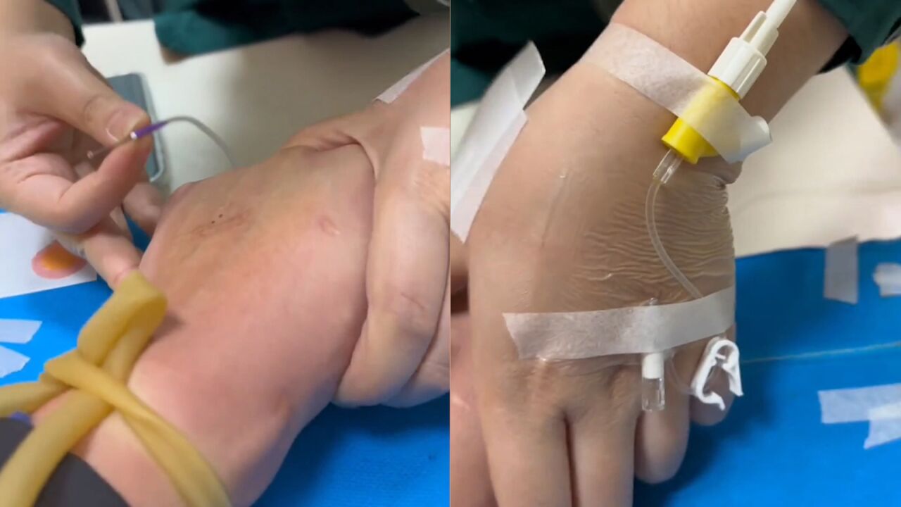 男子去医院输液,发现3名护士都插着预留针瞬间心疼:太不容易了