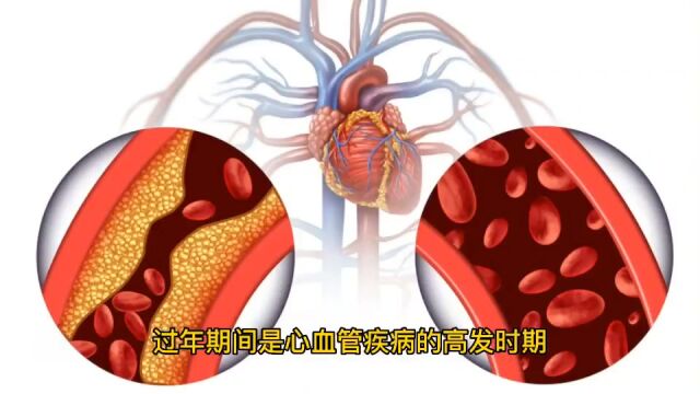 春节期间,心血管患者学会这5个技巧,可安心健康过大年