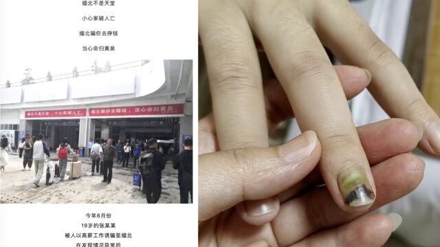 19岁女子受高薪工作诱惑被骗至缅甸,获救时遍体鳞伤:遭电诈集团多次殴打转卖