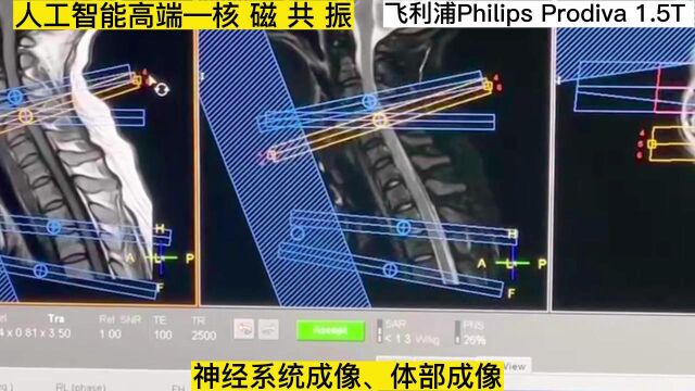 核磁——盐海医院引起飞利浦1.5T核磁共振