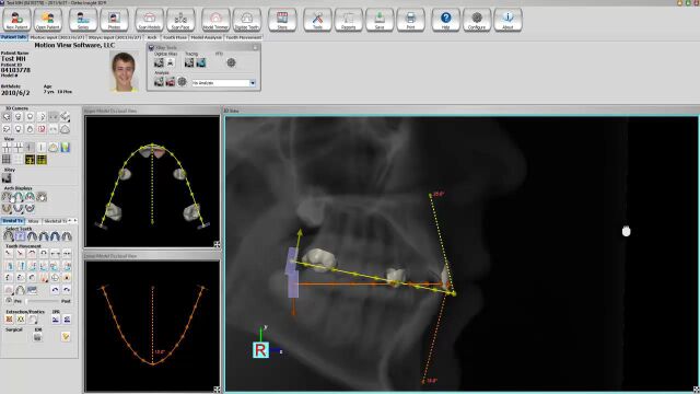 More intelligent dental CAD software