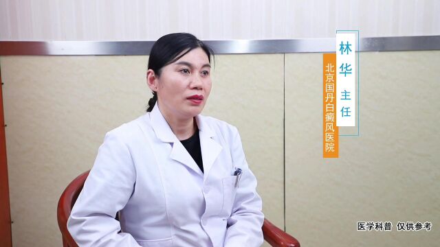 为什么稳定期白癜风不能“高枕无忧”切勿疏忽大意