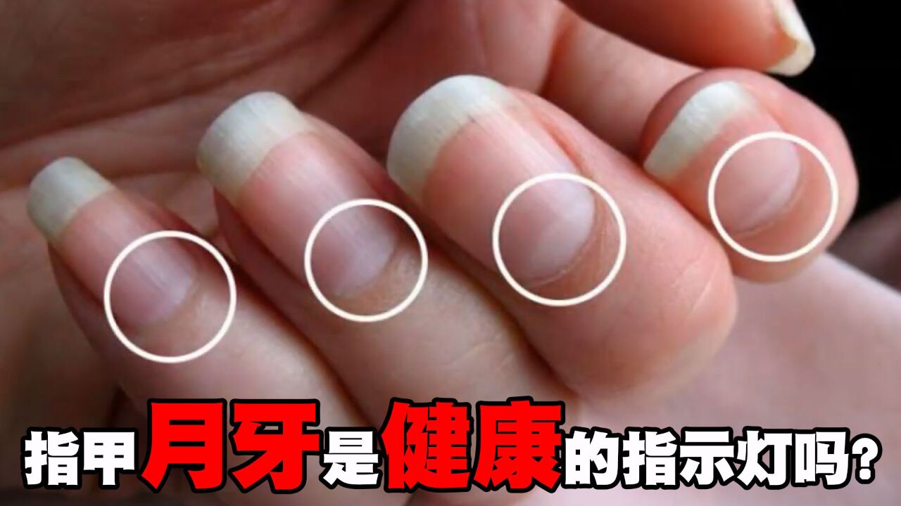 月牙是指甲健康的指示灯吗?月牙长啥样才是健康的?