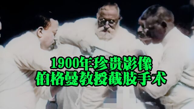 1900年珍贵影像,德国“外科大师”伯格曼截肢手术