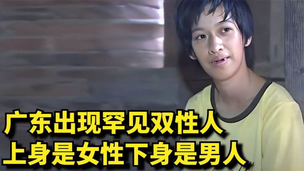 广东出现罕见双性人,上身是女性下身是男人,医生的话让人意外