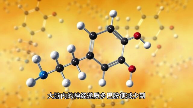 帕金森病是怎么得的?这几点要知道