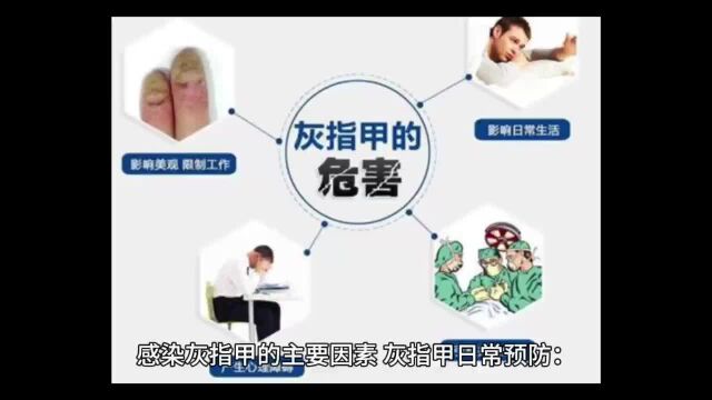 灰指甲怎么治疗效果好?