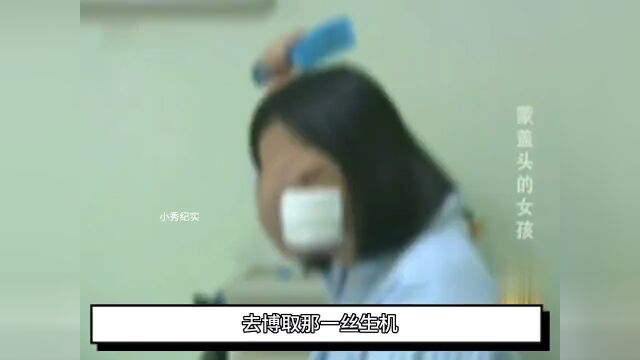 22岁女孩长了一张“马脸”,蒙面13年不敢出门,医生看到都直呼害怕 3