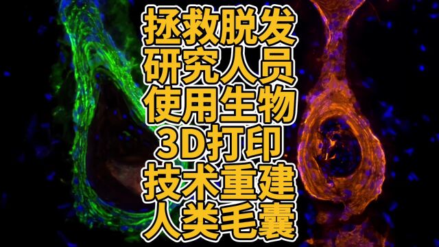 拯救脱发!研究人员使用生物3D打印技术重建人类毛囊