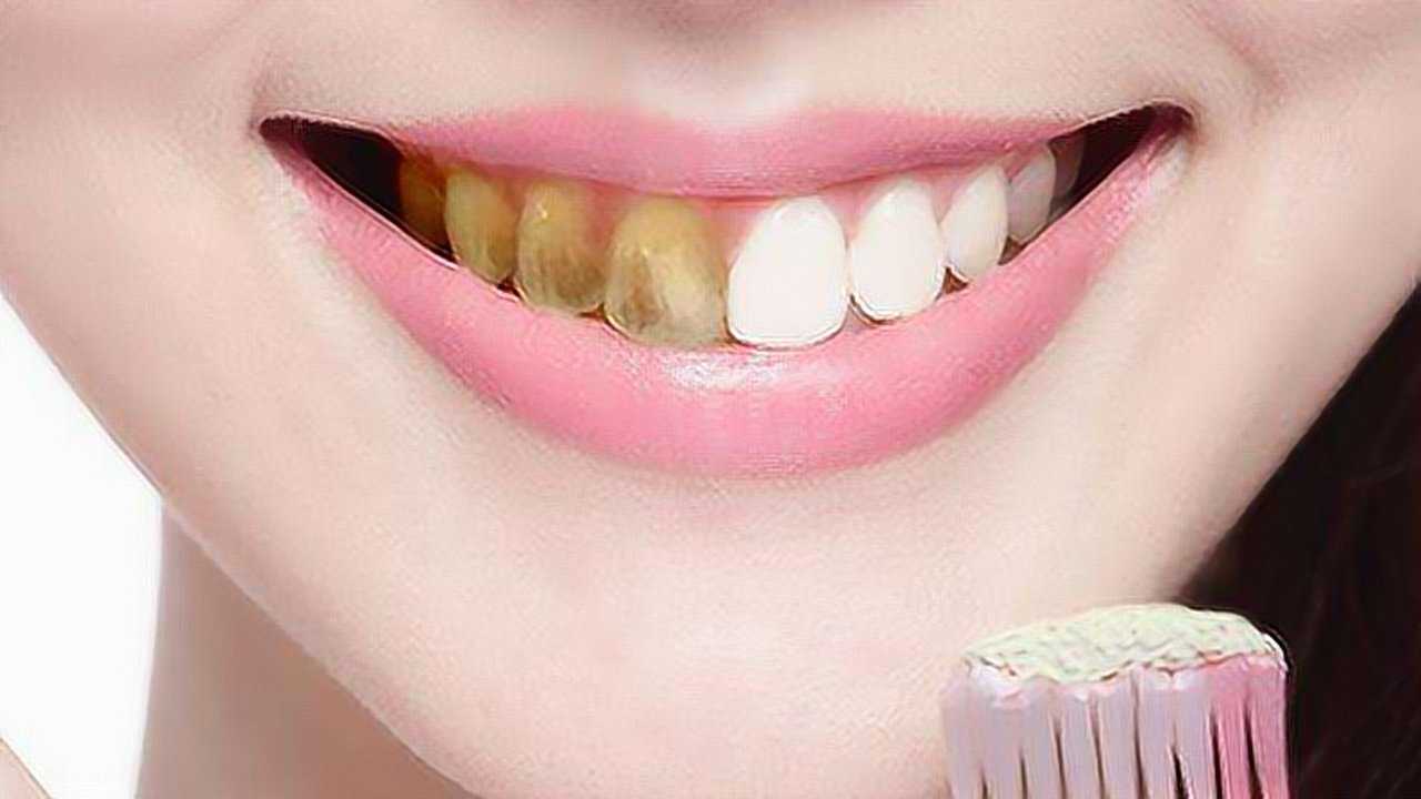 牙黄口臭不用怕教你3招1分钟美白牙齿去除口臭