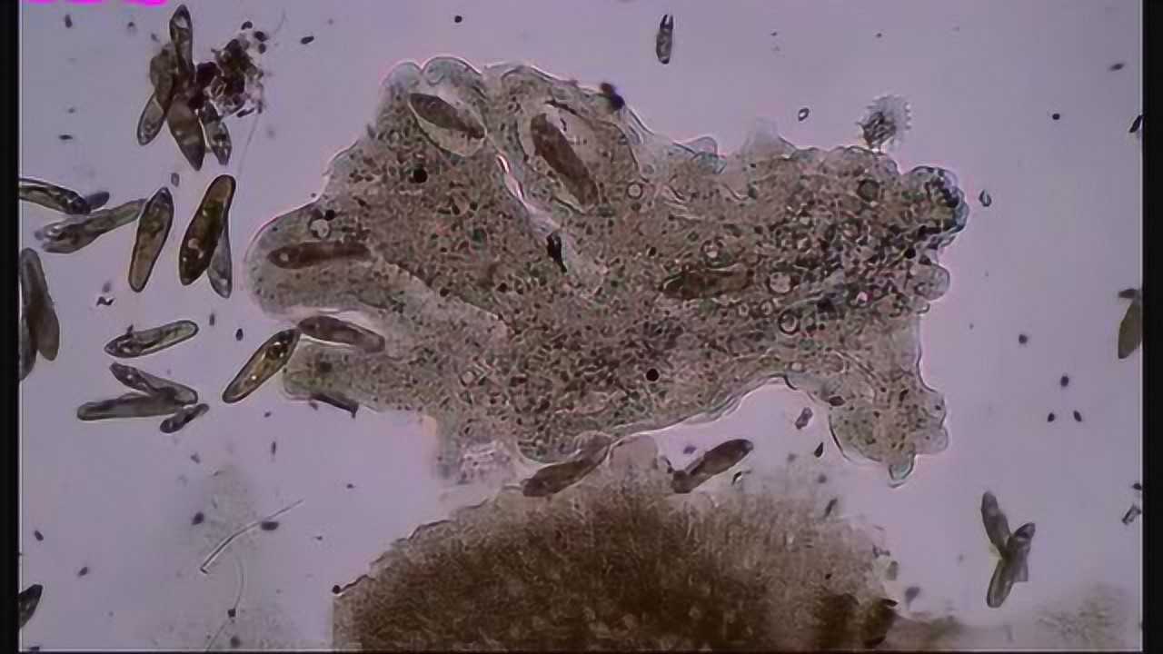显微镜下的变形虫图片图片