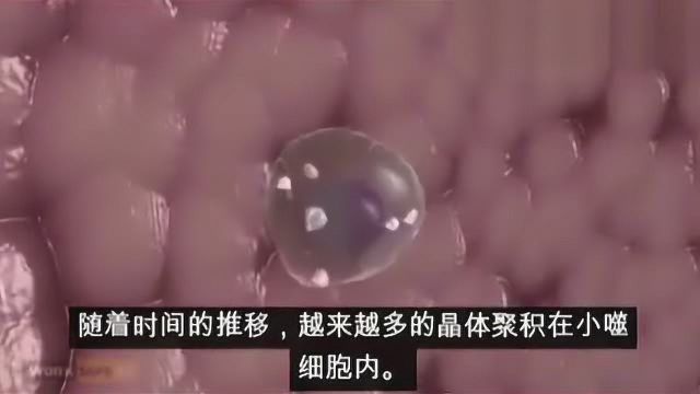 二氧化硅超标危害你知道吗