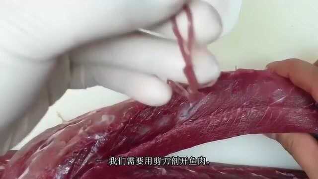 鱼体内居然藏有如此多的寄生虫,看得都不敢吃鱼了