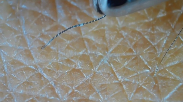 将拔头发的过程用显微镜放大1000倍,看完你还敢拔头发吗?