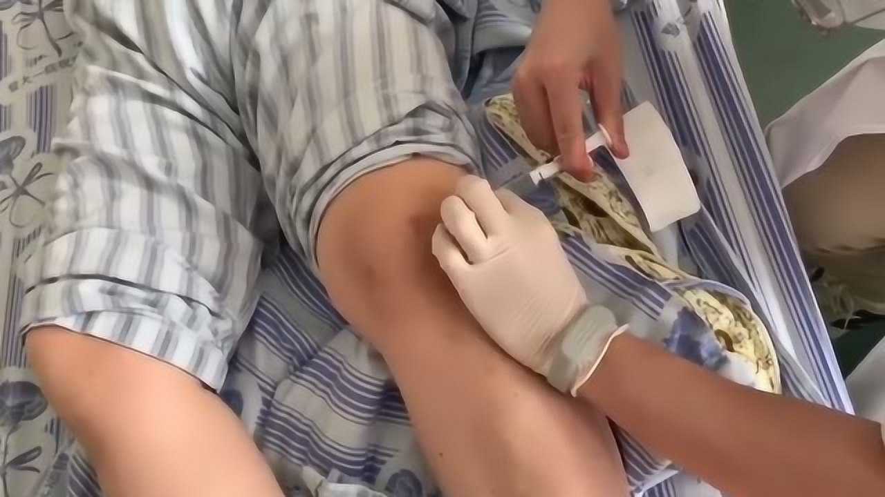 给膝关节腔打玻璃酸钠没想到很多人都感同身受
