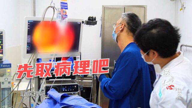 癌变?29岁男子便条变细、便血、腹痛,医生:出现这些情况要早诊