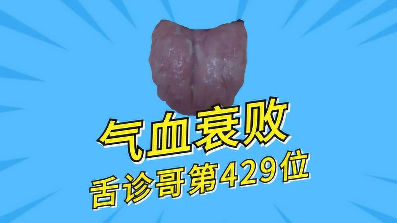 舌背舌腹图片