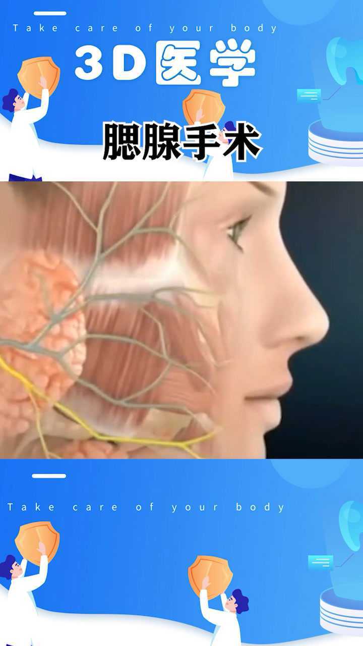 3D医学：腮腺手术的过程，看完就懂_高清