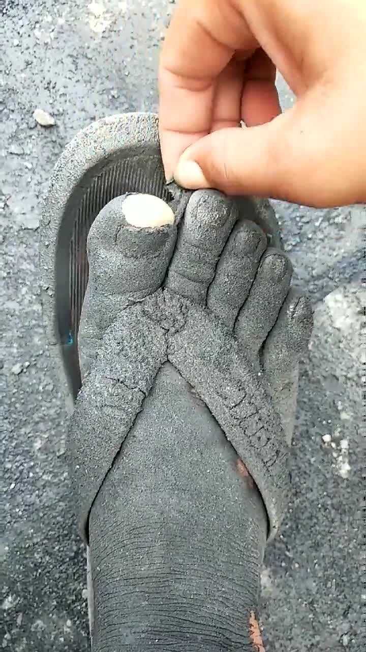 这是多久没洗脚能有这个状态