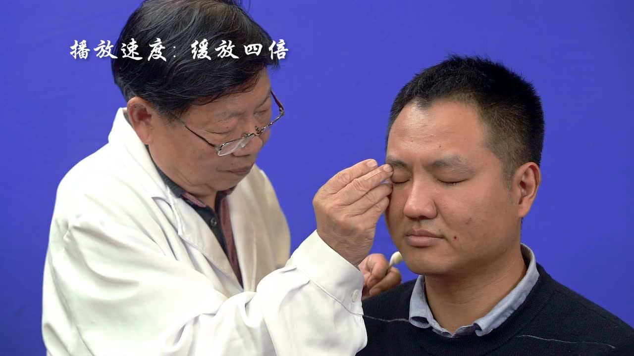 《张仁特色针刺技法》22--三针齐刺法_高清1080p在线观看平台_腾讯