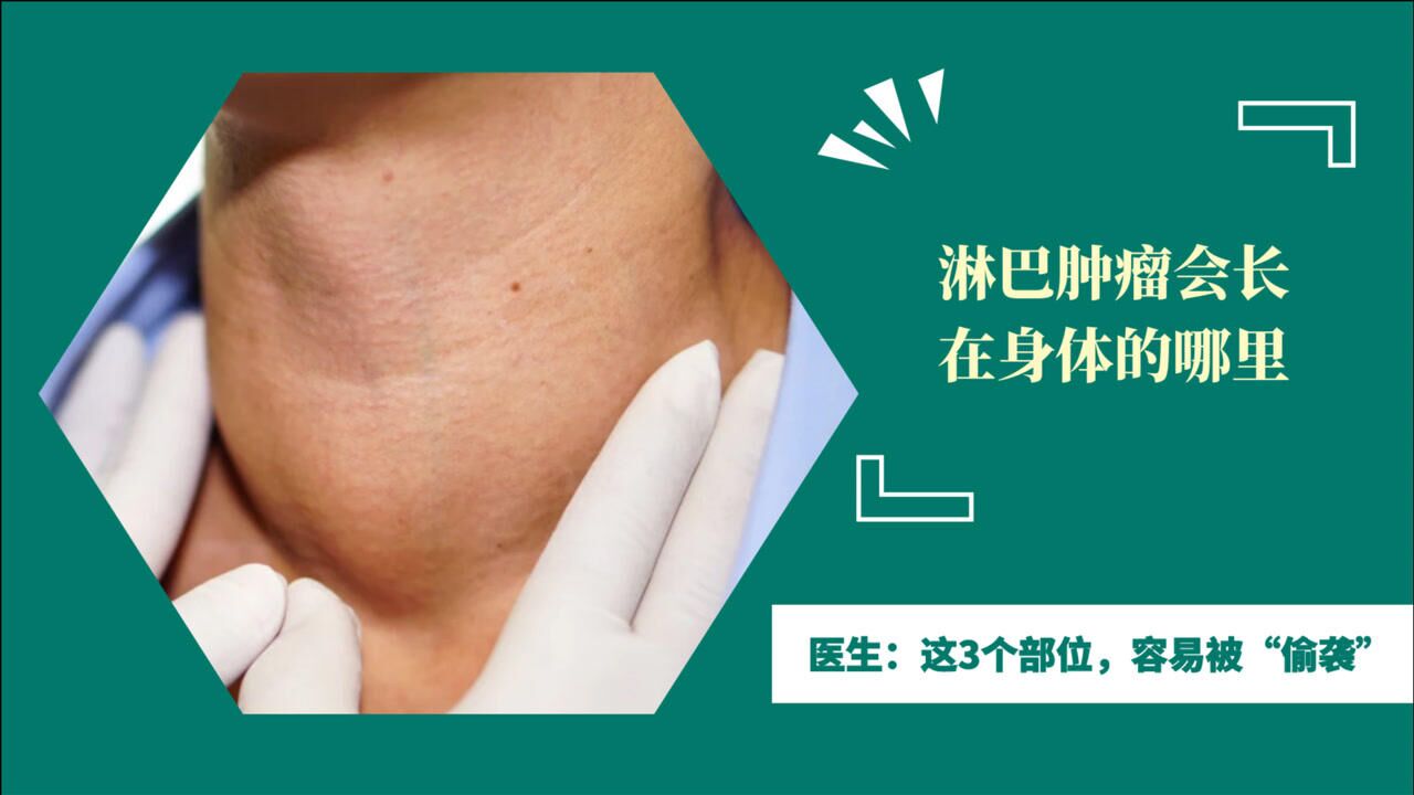 淋巴肿瘤会长在身体的哪里?医生:这3个部位,容易被"偷袭"