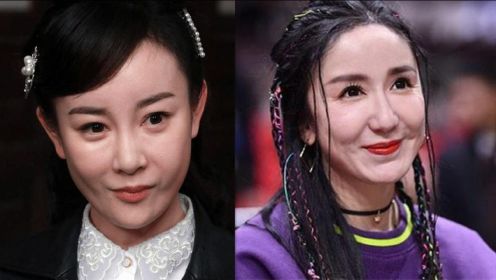 整容失败的五位女星,娄艺潇女神变女鬼,张檬无戏可拍令人惋惜