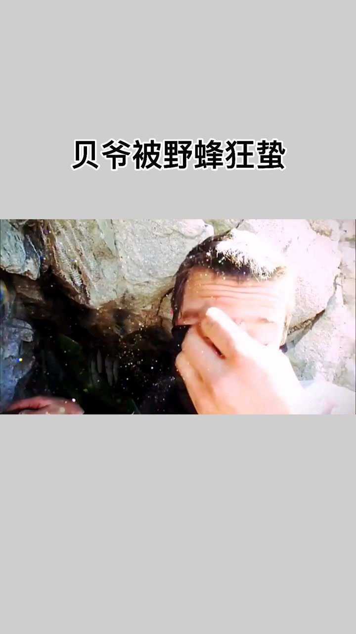 贝爷被野蜂狂蛰