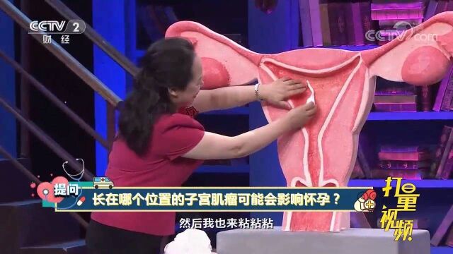 子宫肌瘤长在哪可能影响怀孕?专家通过道具讲解