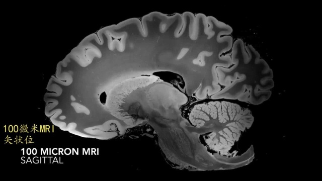 迄今最完整最高清人脑的7T磁共振成像,比临床头部图像详细1000倍