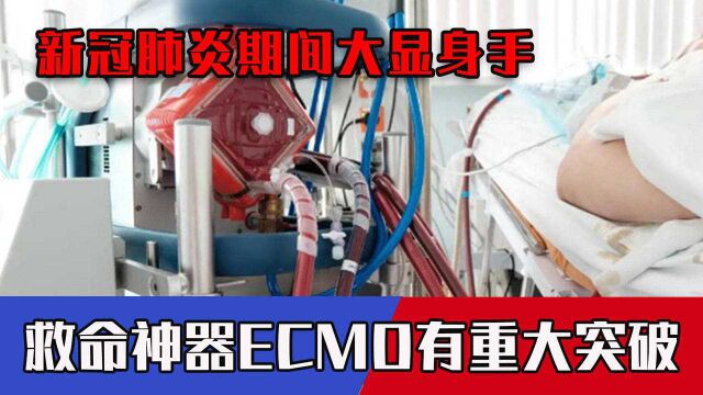 新冠肺炎期间大显身手,ECMO有重大突破,关键技术100%国产