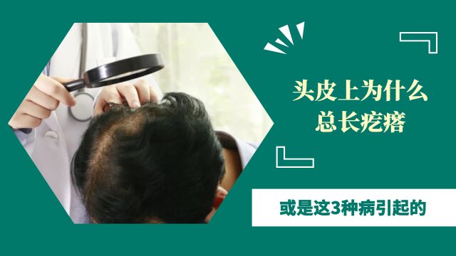 头皮上为什么总长疙瘩?或是这3种病引起的,不信检查试试