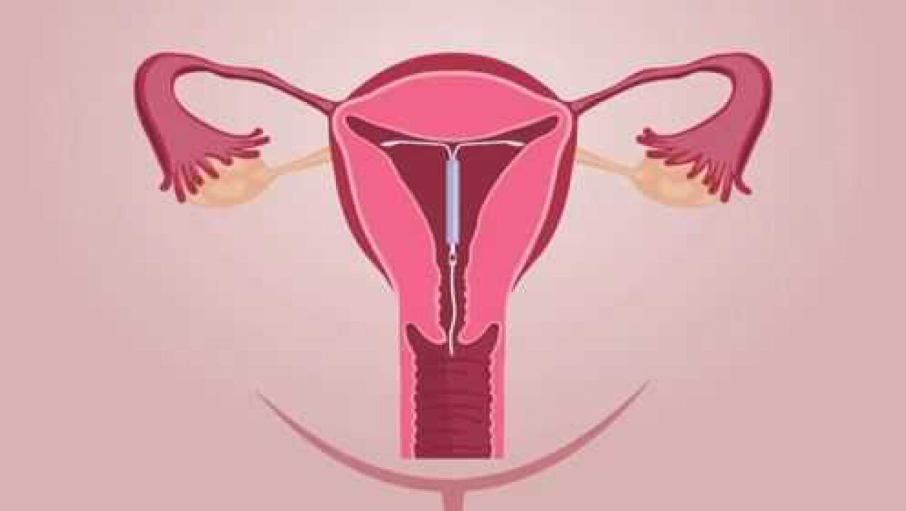 女性生殖器官大概在什么位置？医生教你：正确认识女性生殖器官。_腾讯视频