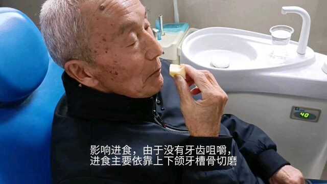 永川口腔医院为高龄老人安装吸附性义齿