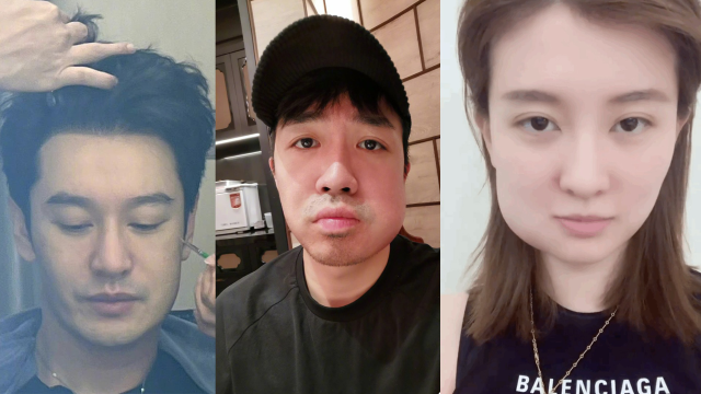 盘点明星拔智齿搞笑名场面!黄晓明撞脸表情包,刘宪华乔欣变猪头