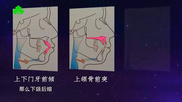 11月30日15:00直播预告|上海市口腔医院 ⷠ复旦大学附属口腔医院刘月华:“龅牙”不仅仅是牙突