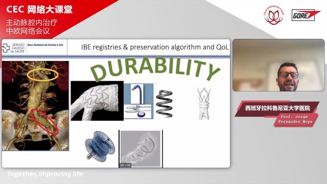精彩荟萃「CEC 网络大课堂」主动脉腔内治疗中欧网络会议