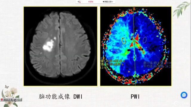 影像学——钱丽霞主任