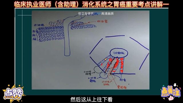 临床执业医师(含助理)消化系统之胃癌重要考点讲解一