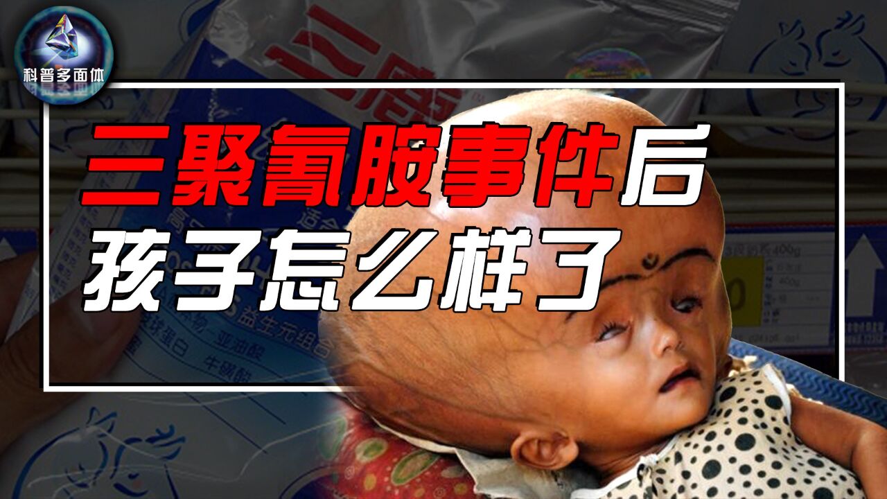 三聚氰胺事件过去13年，被三鹿奶粉毒害的30万孩子，现在咋样了_高清
