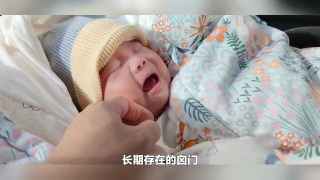 你了解囟门的知识吗?