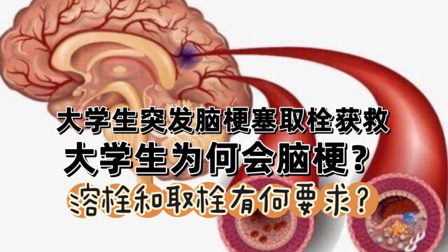 大学生突发脑梗取栓获救,年轻人为何会脑梗?溶栓和取栓有何要求